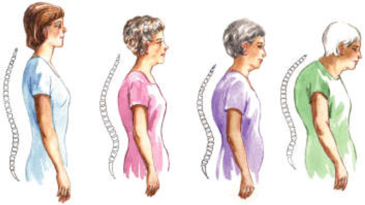 aging posture